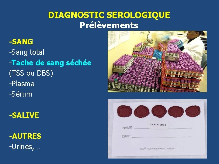 DIAGNOSTIC SEROLOGIQUE Prélèvements -SANG -Sang total -Tache de sang séchée (TSS ou DBS) -Plasma