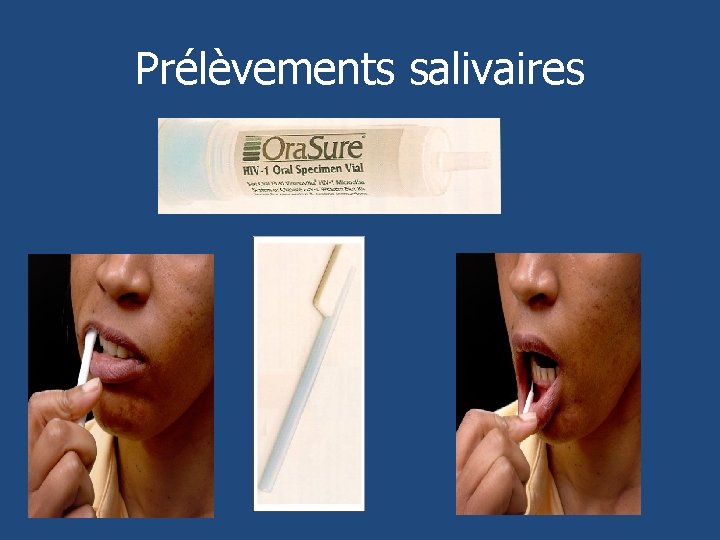 Prélèvements salivaires 