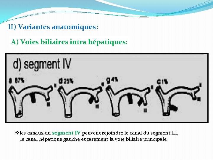 II) Variantes anatomiques: A) Voies biliaires intra hépatiques: vles canaux du segment IV peuvent