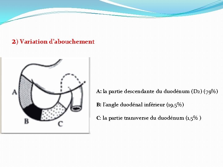 2) Variation d’abouchement A: la partie descendante du duodénum (D 2) (79%) B: l’angle