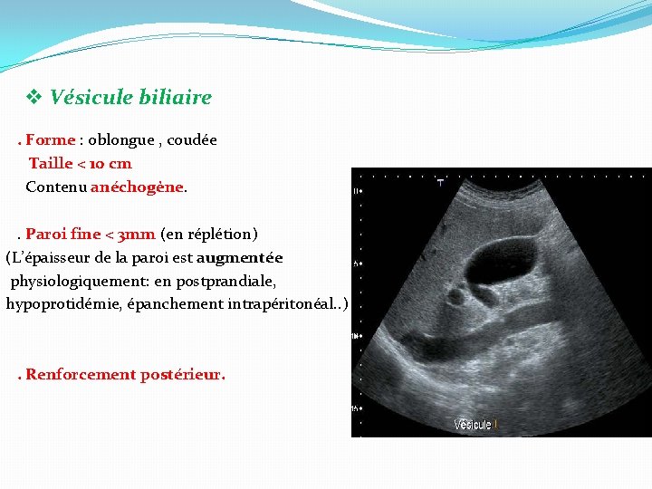 v Vésicule biliaire . Forme : oblongue , coudée Taille < 10 cm Contenu