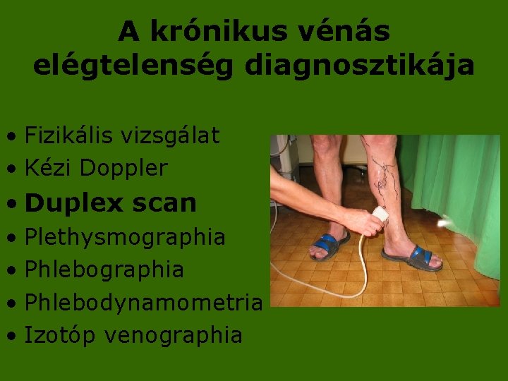 A krónikus vénás elégtelenség diagnosztikája • Fizikális vizsgálat • Kézi Doppler • Duplex scan