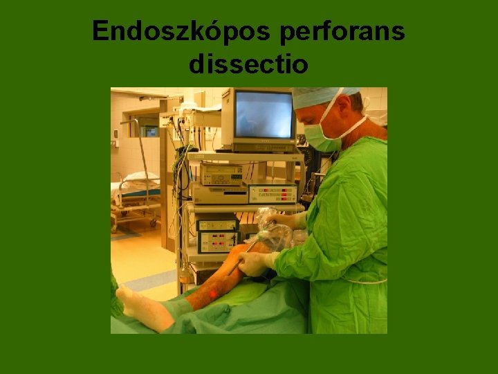 Endoszkópos perforans dissectio 