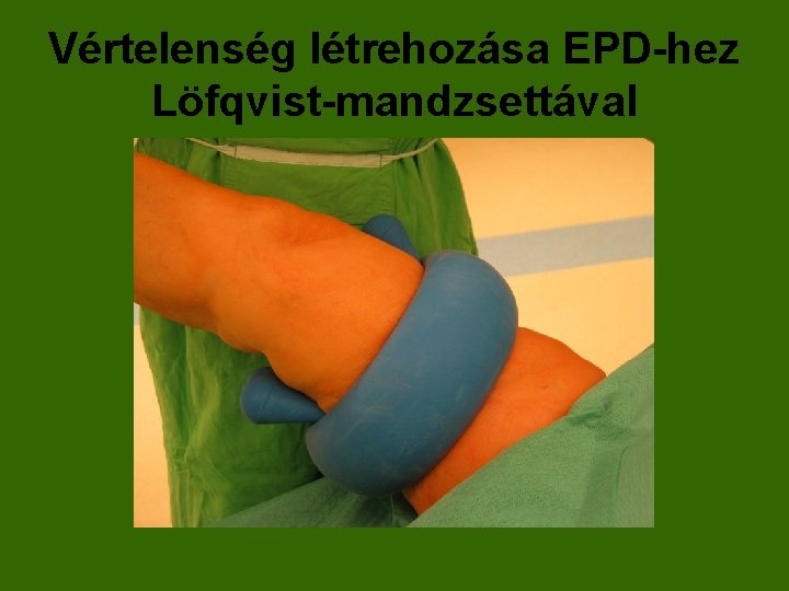 Vértelenség létrehozása EPD-hez Löfqvist-mandzsettával 