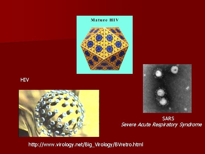 HIV SARS Severe Acute Respiratory Syndrome http: //www. virology. net/Big_Virology/BVretro. html 