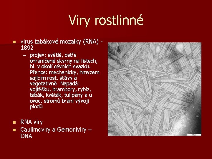 Viry rostlinné n virus tabákové mozaiky (RNA) 1892 – projev: světlé, ostře ohraničené skvrny