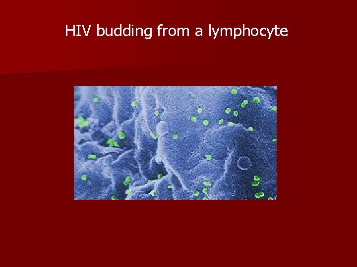 HIV budding from a lymphocyte 