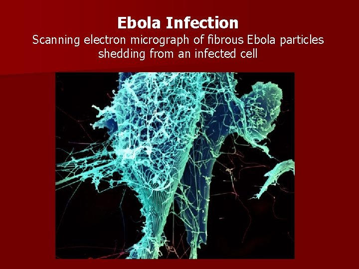 Ebola Infection Scanning electron micrograph of fibrous Ebola particles shedding from an infected cell