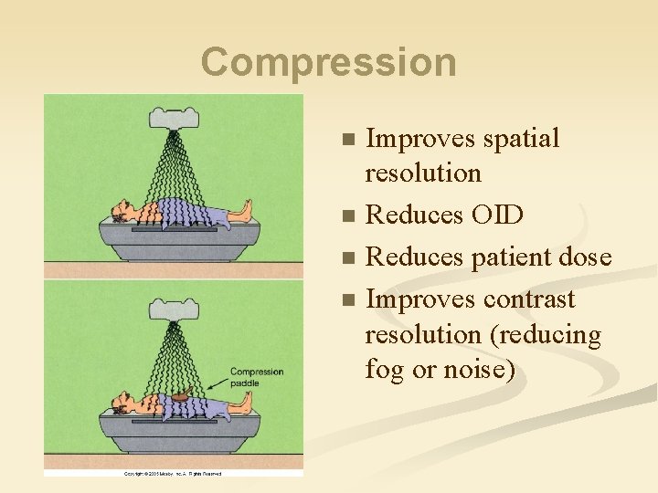 Compression Improves spatial resolution n Reduces OID n Reduces patient dose n Improves contrast