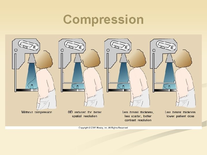 Compression 
