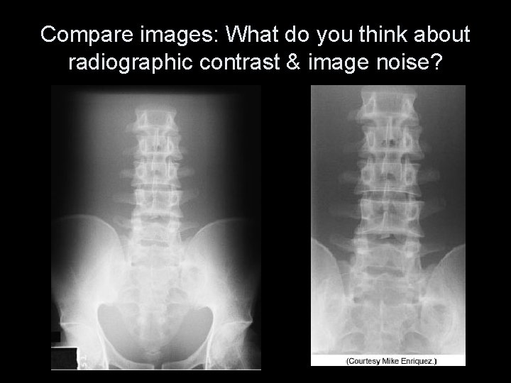 Compare images: What do you think about radiographic contrast & image noise? 