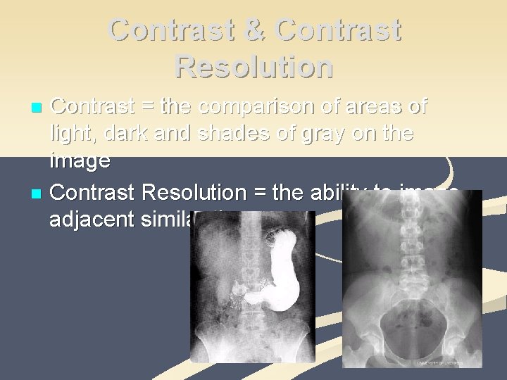 Contrast & Contrast Resolution Contrast = the comparison of areas of light, dark and