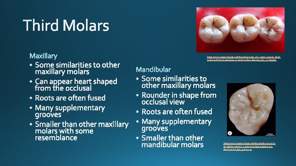 https: //www. researchgate. net/figure/Example-of-a-mesio-angular-thirdmolar-with-food-retentive-occlusal-surface-fissures_fig 2_271839875 https: //www. researchgate. net/figure/Macroscopica lly-visible-crown-a-c-and-root-discoloration-d-g. Buccal-a-d-f_fig 1_51204415 