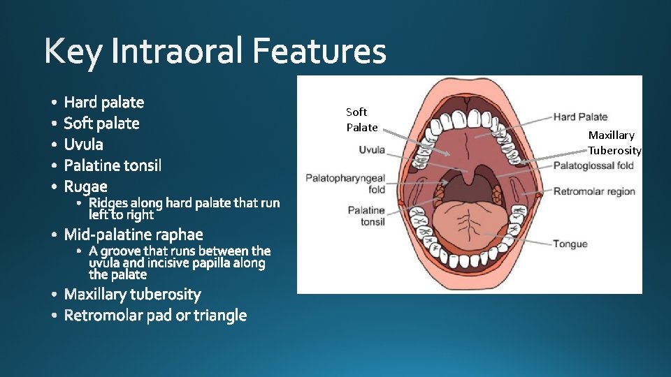 Soft Palate Maxillary Tuberosity 