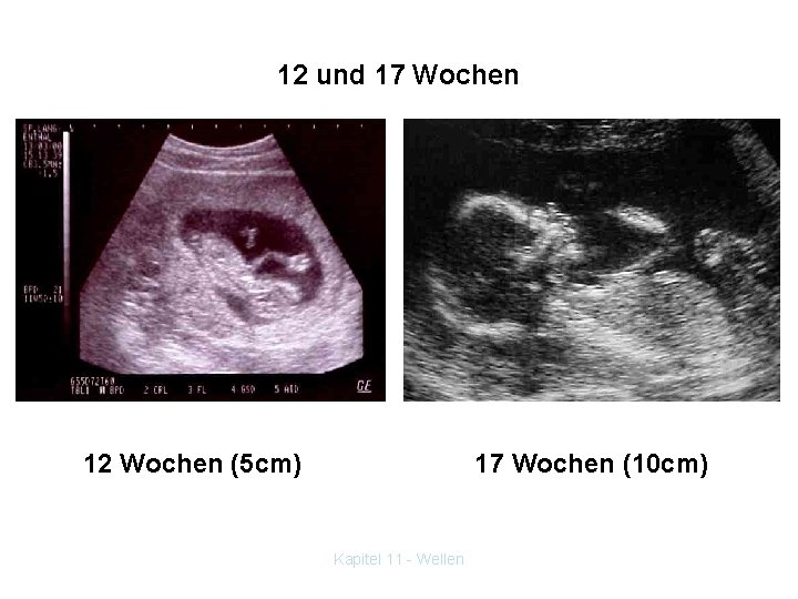 12 und 17 Wochen 12 Wochen (5 cm) 17 Wochen (10 cm) Kapitel 11