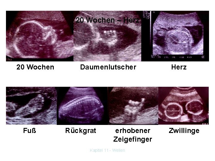 20 Wochen – Herz 20 Wochen Fuß Daumenlutscher Rückgrat erhobener Zeigefinger Kapitel 11 -