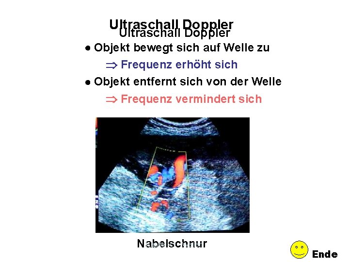 Ultraschall Doppler Objekt bewegt sich auf Welle zu Frequenz erhöht sich Objekt entfernt sich