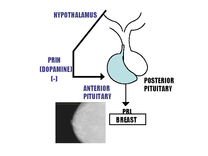 HYPOTHALAMUS PRIH (DOPAMINE) (-) POSTERIOR PITUITARY ANTERIOR PITUITARY PRL BREAST 
