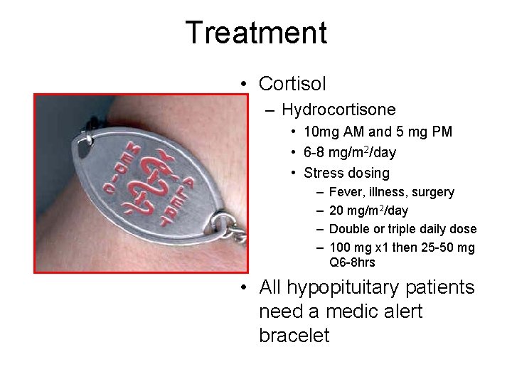 Treatment • Cortisol – Hydrocortisone • 10 mg AM and 5 mg PM •