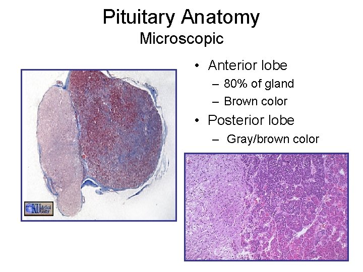 Pituitary Anatomy Microscopic • Anterior lobe – 80% of gland – Brown color •