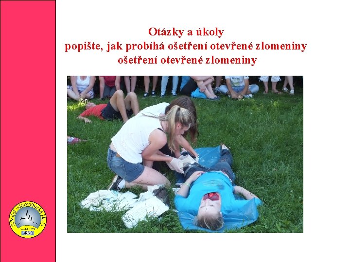 Otázky a úkoly popište, jak probíhá ošetření otevřené zlomeniny 