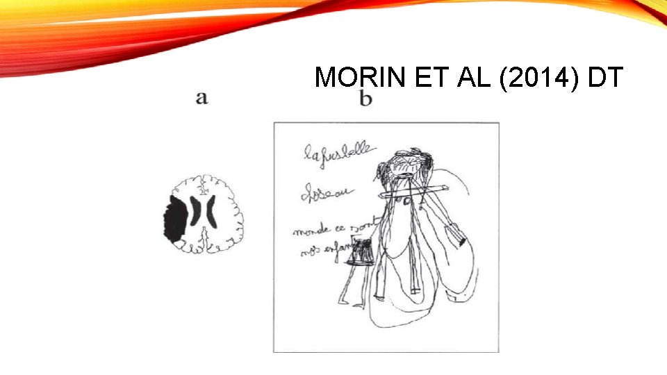 MORIN ET AL (2014) DT 