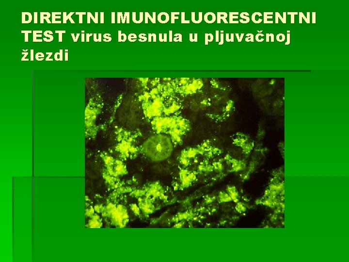 DIREKTNI IMUNOFLUORESCENTNI TEST virus besnula u pljuvačnoj žlezdi 