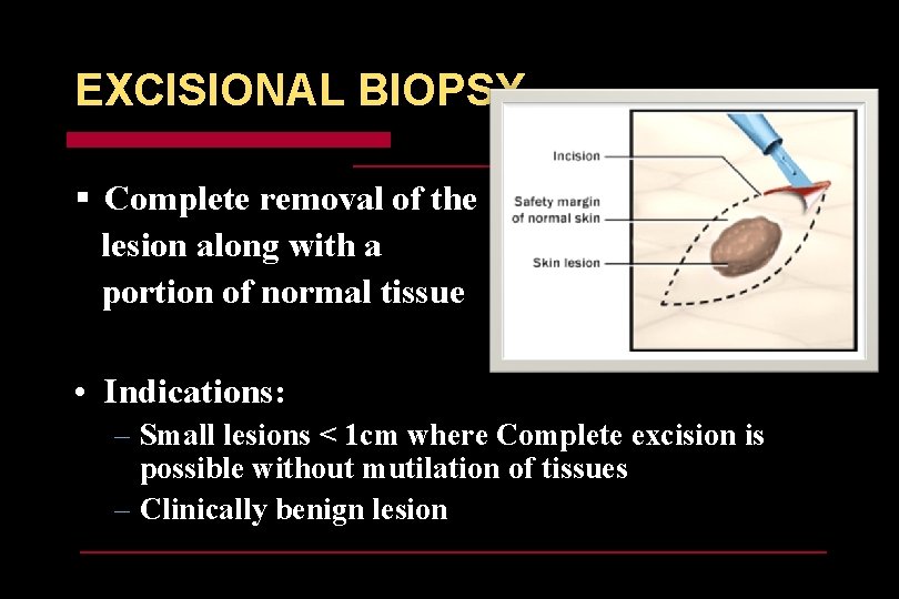 BIOPSY INTRODUCTION The famous theme that The best