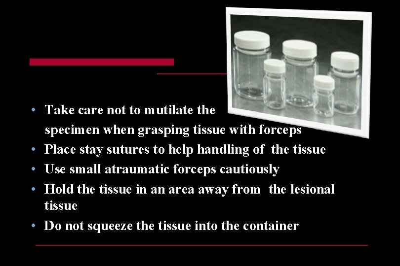  • Take care not to mutilate the specimen when grasping tissue with forceps