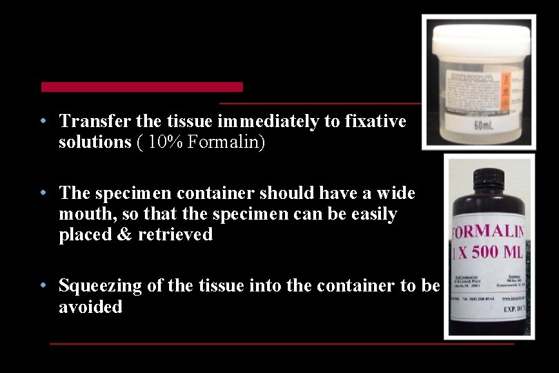  • Transfer the tissue immediately to fixative solutions ( 10% Formalin) • The