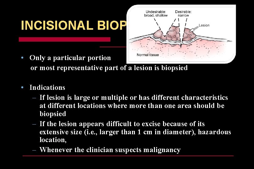 INCISIONAL BIOPSY • Only a particular portion or most representative part of a lesion