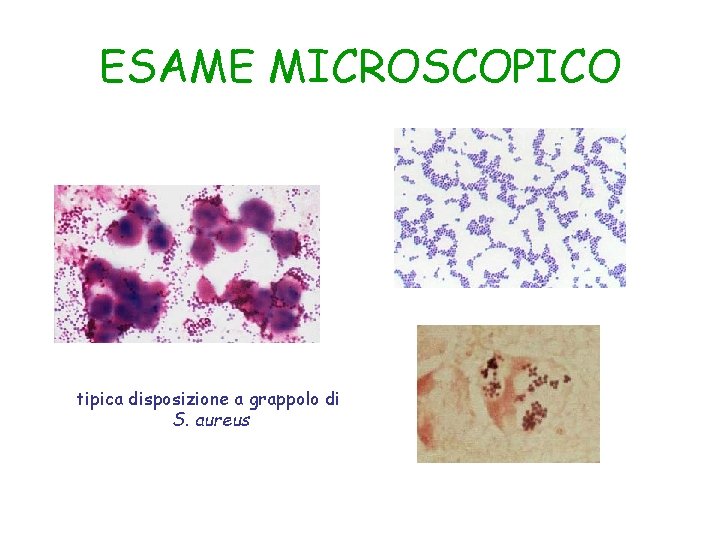 ESAME MICROSCOPICO tipica disposizione a grappolo di S. aureus 