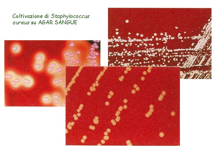 Coltivazione di Staphylococcus aureus su AGAR SANGUE 