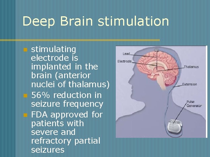 Deep Brain stimulation n stimulating electrode is implanted in the brain (anterior nuclei of