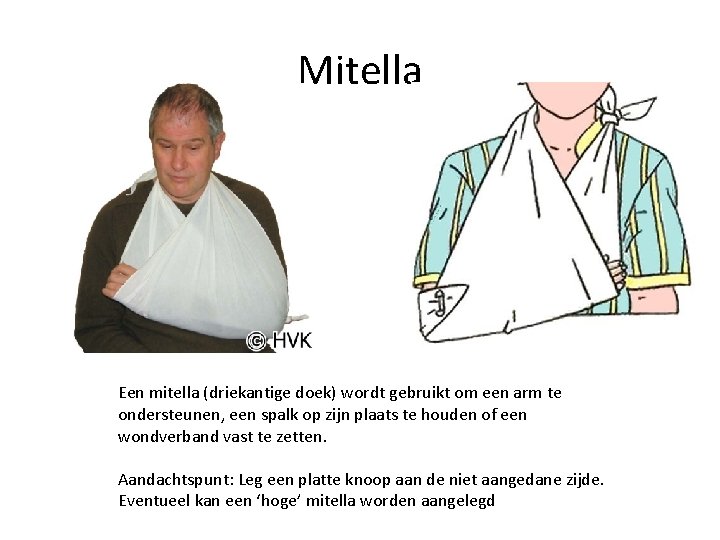 Mitella Een mitella (driekantige doek) wordt gebruikt om een arm te ondersteunen, een spalk