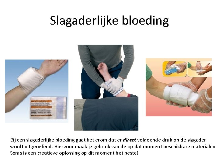 Slagaderlijke bloeding Bij een slagaderlijke bloeding gaat het erom dat er direct voldoende druk