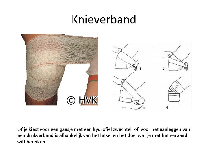 Knieverband Of je kiest voor een gaasje met een hydrofiel zwachtel of voor het