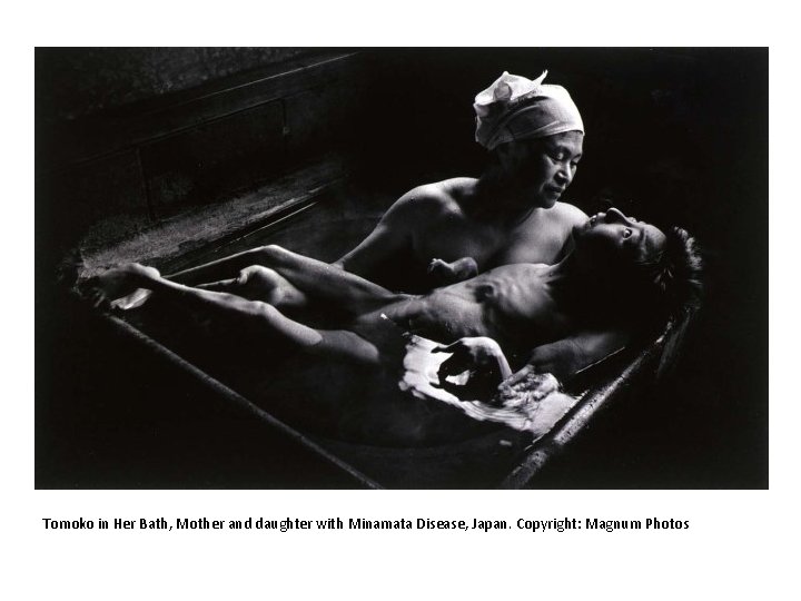 NYC, 1956. Copyright: Magnum Photos Tomoko in Her Bath, Mother and daughter with Minamata