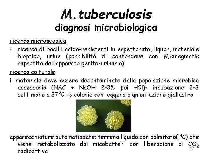 M. tuberculosis diagnosi microbiologica ricerca microscopica • ricerca di bacilli acido-resistenti in espettorato, liquor,