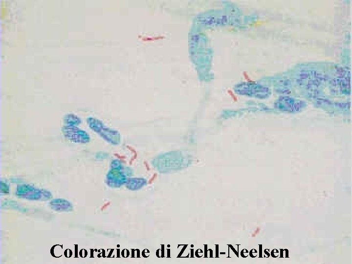 Colorazione di Ziehl-Neelsen 19 