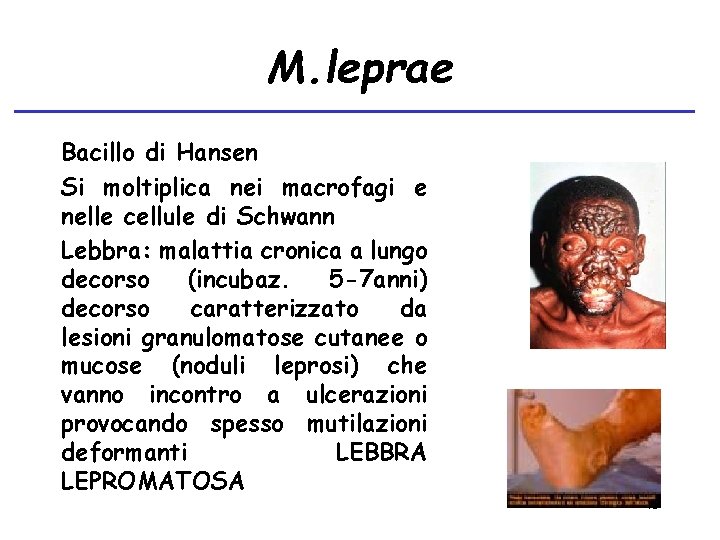 M. leprae Bacillo di Hansen Si moltiplica nei macrofagi e nelle cellule di Schwann