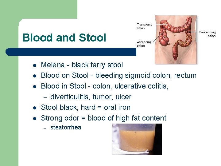 Blood and Stool l l Melena - black tarry stool Blood on Stool -