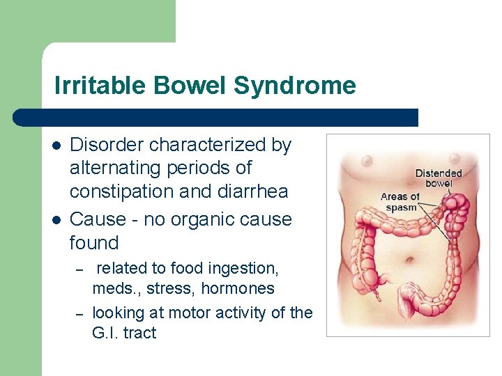 Irritable Bowel Syndrome l l Disorder characterized by alternating periods of constipation and diarrhea