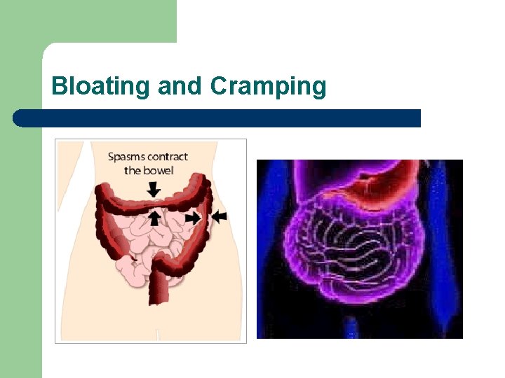 Bloating and Cramping 