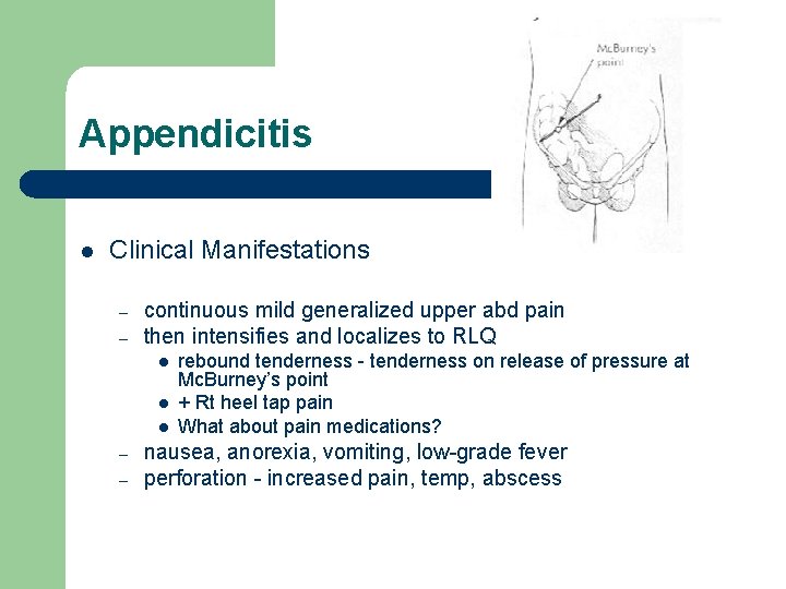 Appendicitis l Clinical Manifestations – – continuous mild generalized upper abd pain then intensifies