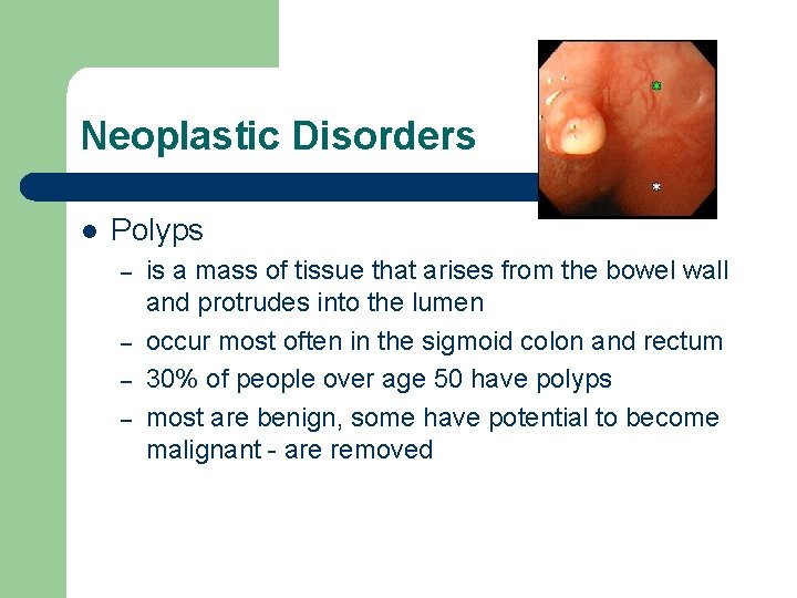 Neoplastic Disorders l Polyps – – is a mass of tissue that arises from