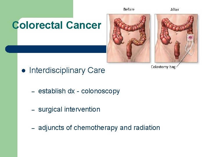 Colorectal Cancer l Interdisciplinary Care – establish dx - colonoscopy – surgical intervention –