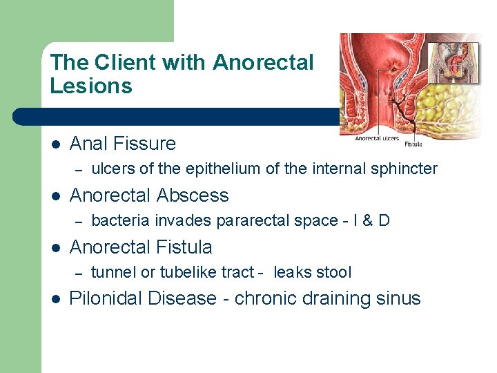 The Client with Anorectal Lesions l Anal Fissure – l Anorectal Abscess – l