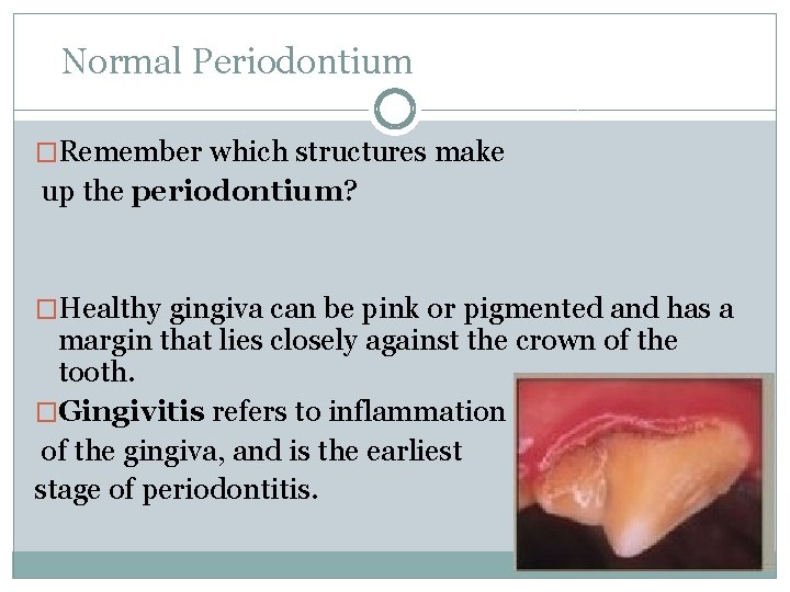 Normal Periodontium �Remember which structures make up the periodontium? �Healthy gingiva can be pink