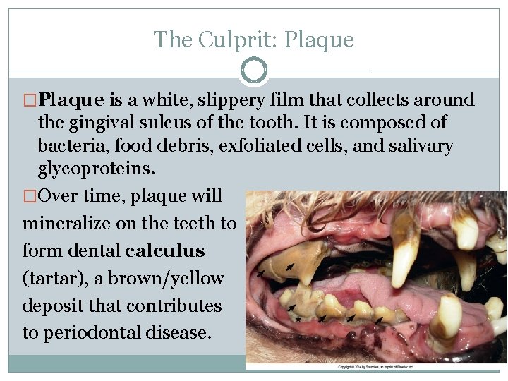 The Culprit: Plaque �Plaque is a white, slippery film that collects around the gingival